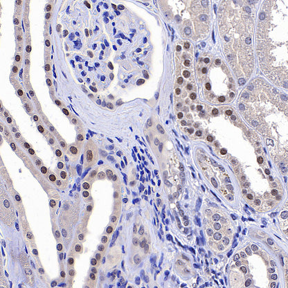 PAPSS1 Recombinant Rabbit mAb (S-3516-9)