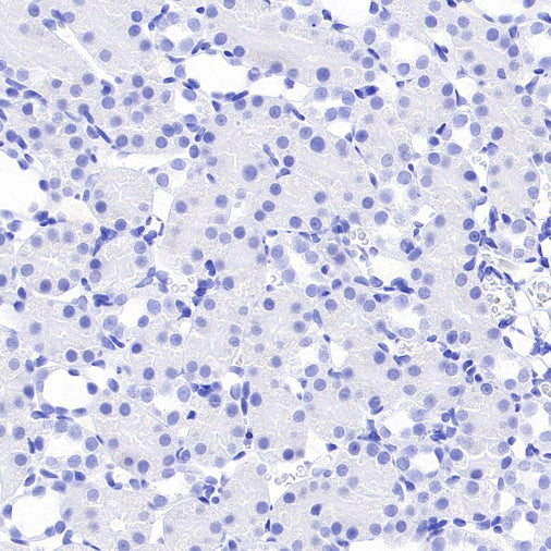 GABRD Recombinant Rabbit mAb (S-1584-162)