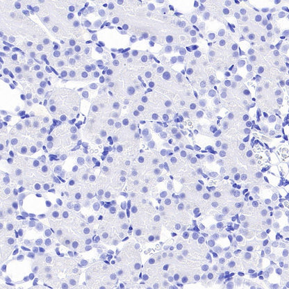 GABRD Recombinant Rabbit mAb (S-1584-162)