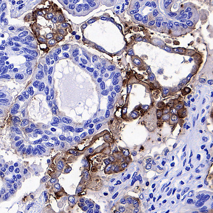 CEA Recombinant Rabbit mAb (SDT-098-63)