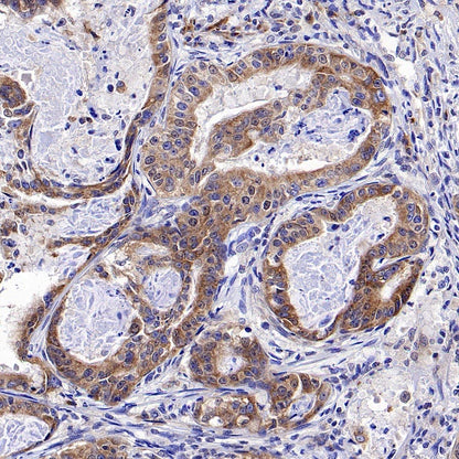 FUNDC1 Rabbit Polyclonal Antibody