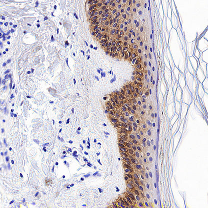 Cytokeratin 14 Recombinant Mouse mAb (S-M0003)