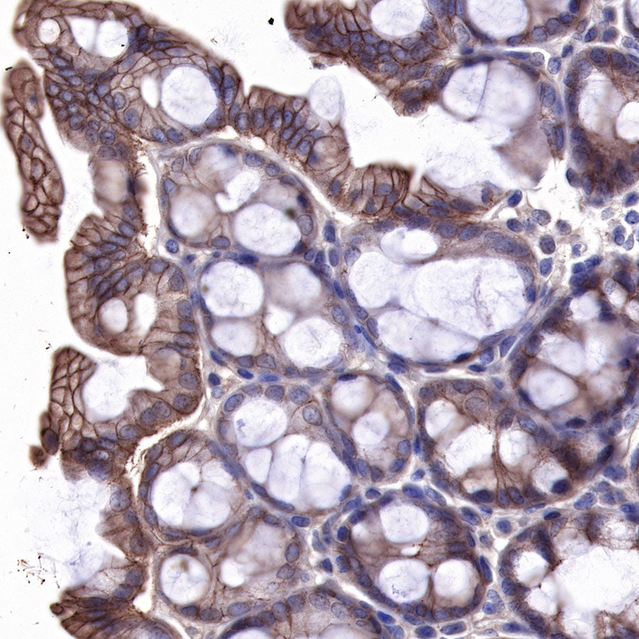 EGFR Recombinant Rabbit mAb (SDT-R110)