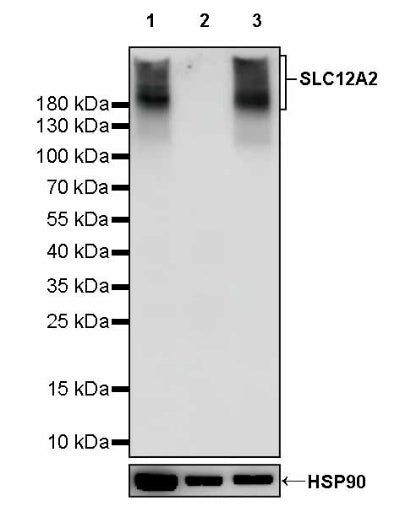 SLC12A2 Recombinant Rabbit mAb (S-2437-30)