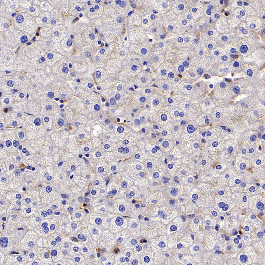 BCAR1 Recombinant Rabbit mAb (S-3542-49)