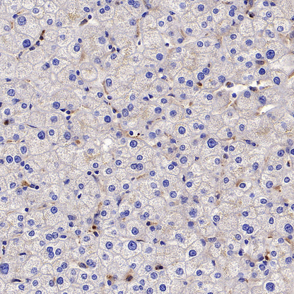 BCAR1 Recombinant Rabbit mAb (S-3542-49)