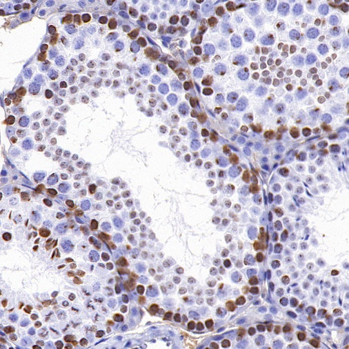 Phospho-Histone H2A.X (Ser139) Recombinant Rabbit mAb (S-1368-15)
