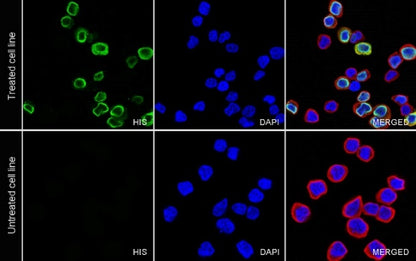 His tag (C-terminal) Recombinant Rabbit mAb (S-1398-10)