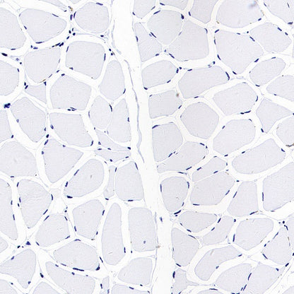 NaPi2b/SLC34A2 Recombinant Rabbit mAb (SDT-1771-79)