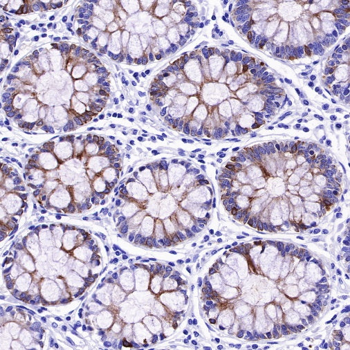 MUC4 Recombinant Rabbit mAb (SDT-R228)