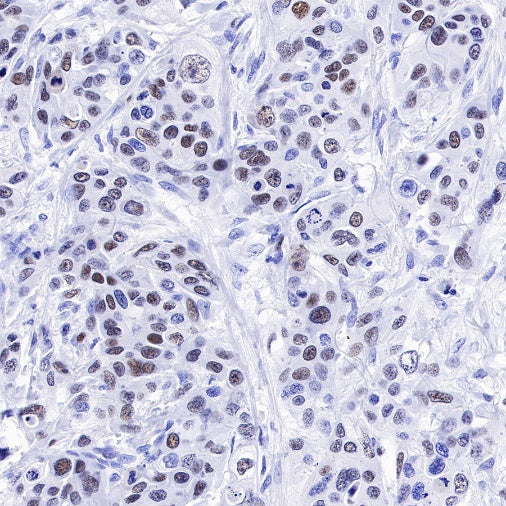 CHAF1b Recombinant Rabbit mAb (S-R316)