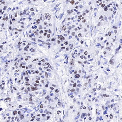 CHAF1b Recombinant Rabbit mAb (S-R316)