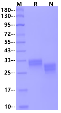 CXADR/CAR His Tag Protein, Human