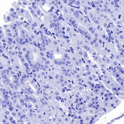 EGR2 Recombinant Rabbit mAb (S-741-136)