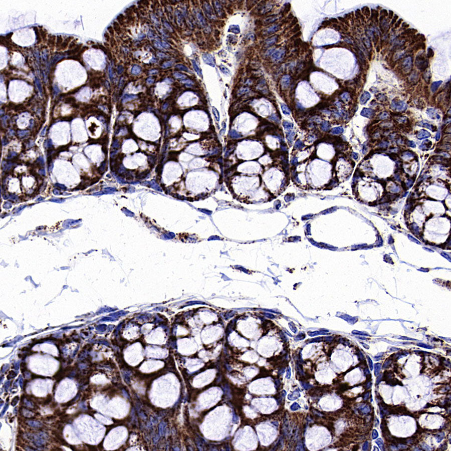 HSP60 Recombinant Mouse mAb (S-5385)