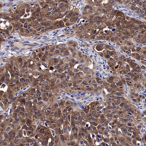 PPIA Recombinant Rabbit mAb (S-2406-28)