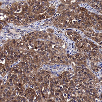 PPIA Recombinant Rabbit mAb (S-2406-28)