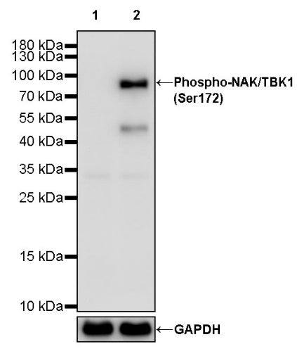 Phospho-NAK/TBK1 (Ser172) Recombinant Rabbit mAb (S-3182)