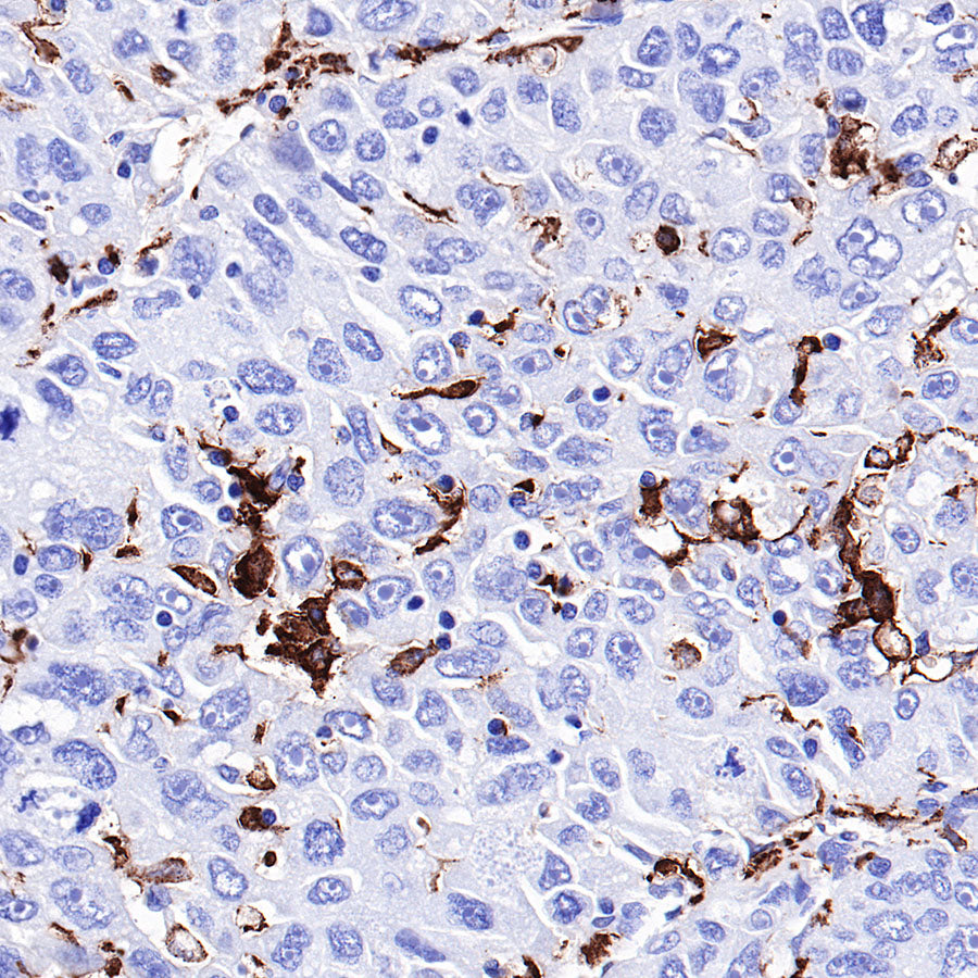 CD163 Recombinant Rabbit mAb,PBS Only (SDT-327-58)