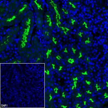 CD10 Recombinant Rabbit mAb (Alexa Fluor® 488 Conjugate) (S-006-77)