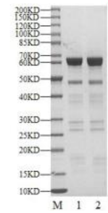 MAPKAPK3 GST Tag Protein, Human