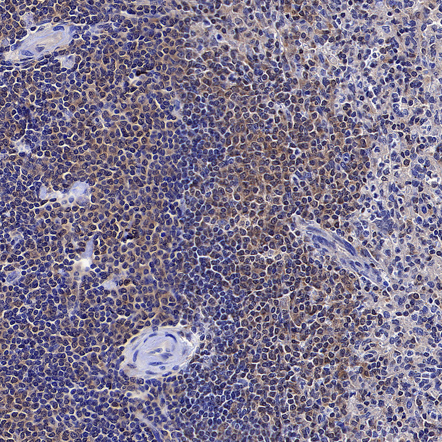 IRF3 Recombinant Rabbit mAb (S-3650-63)