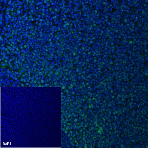MSH2 Recombinant Rabbit mAb (Alexa Fluor® 488 Conjugate) (SDT-037-20)