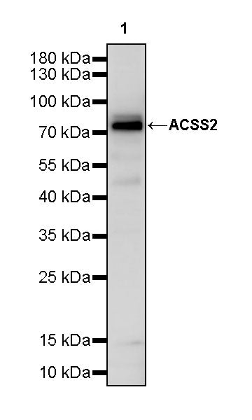 ACSS2 Recombinant Rabbit mAb (S-4117-9)