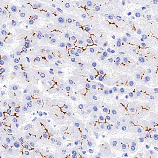 MDR3 Recombinant Rabbit mAb (SDT-1949-60)