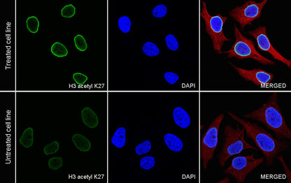 Histone H3 (acetyl K27) Rabbit pAb