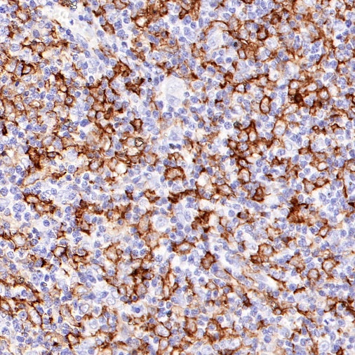 CD14 Mouse mAb (SDT-411-1)