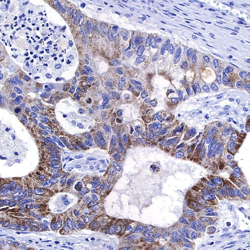 TMPRSS2 Recombinant Rabbit mAb (S-735-40)