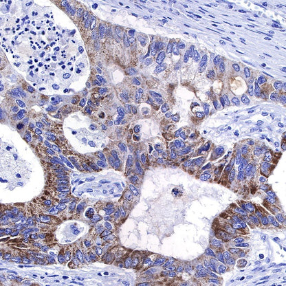 TMPRSS2 Recombinant Rabbit mAb (S-735-40)