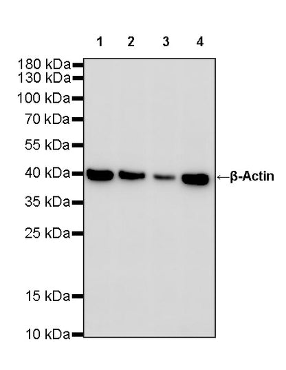 β-Actin Recombinant Rabbit mAb (S-5701)