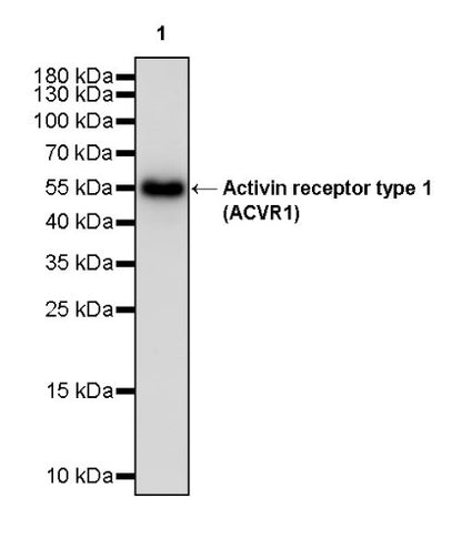 Activin receptor type 1 (ACVR1) Recombinant Rabbit mAb (S-2058-256)