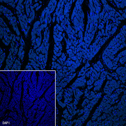 PTH Recombinant Rabbit mAb (SDT-407-4)