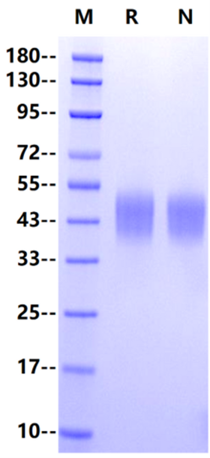 IL-4R alpha/CD124 His Tag Protein, Cynomolgus