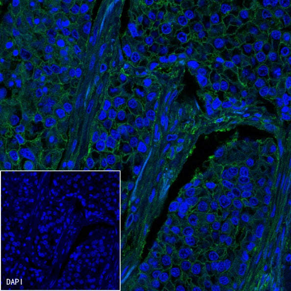 B7-H3 Recombinant Rabbit mAb (SDT-249-26)