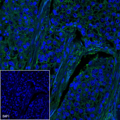 B7-H3 Recombinant Rabbit mAb (SDT-249-26)
