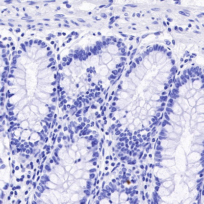 α/β-Synuclein Recombinant Rabbit mAb (S-309-72)