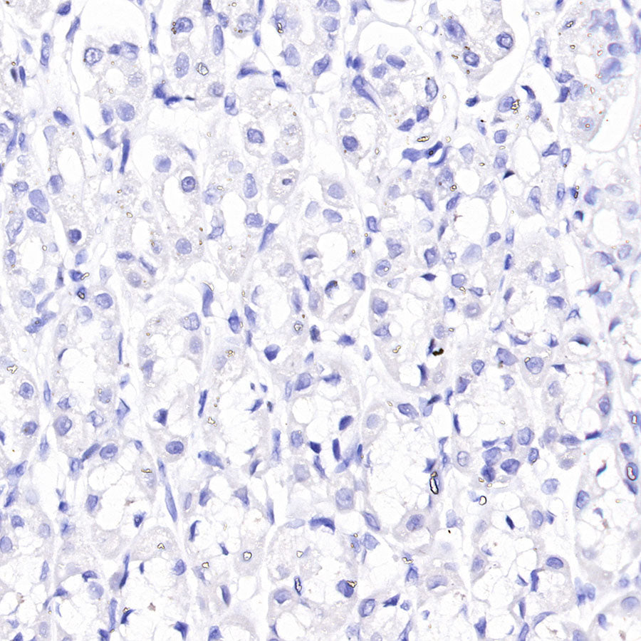 ACTH Recombinant Rabbit mAb (SDT-363-60)