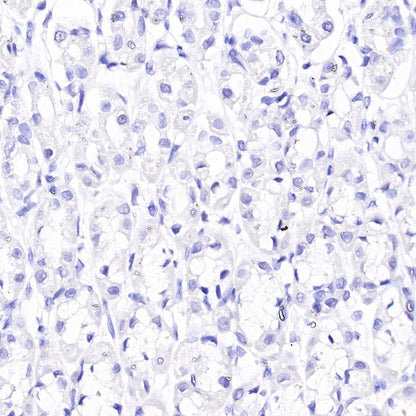 ACTH Recombinant Rabbit mAb (SDT-363-60)
