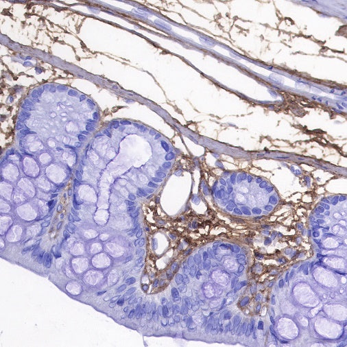 Lumican Recombinant Rabbit mAb (S-247-47)