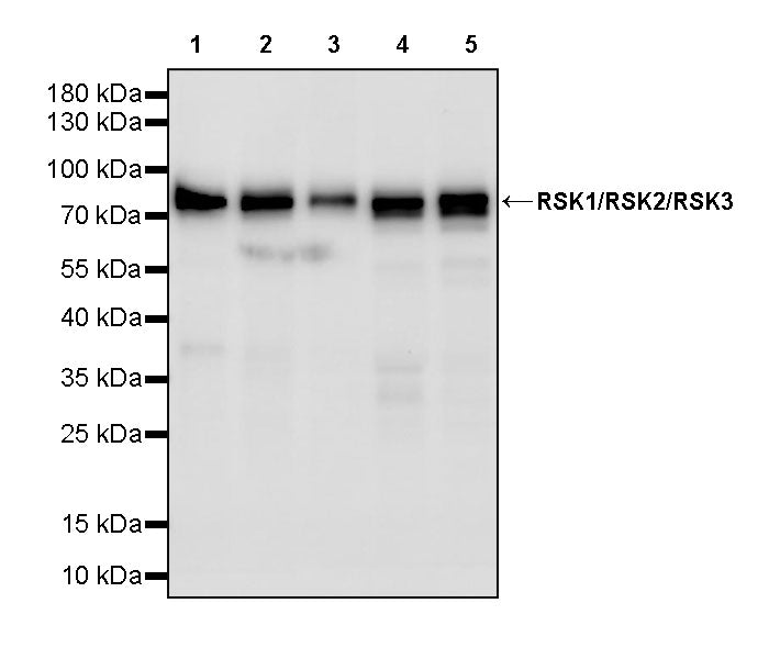 RSK1/RSK2/RSK3 Recombinant Rabbit mAb (S-4982)
