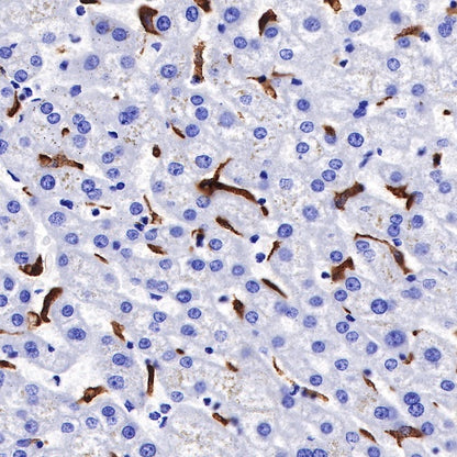 CD163 Recombinant Rabbit mAb (SDT-222-171)