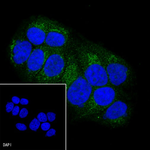 PI3 Kinase p85 Recombinant Rabbit mAb (SDT-R108)