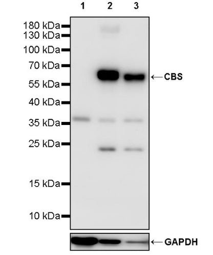 CBS Rabbit Polyclonal Antibody