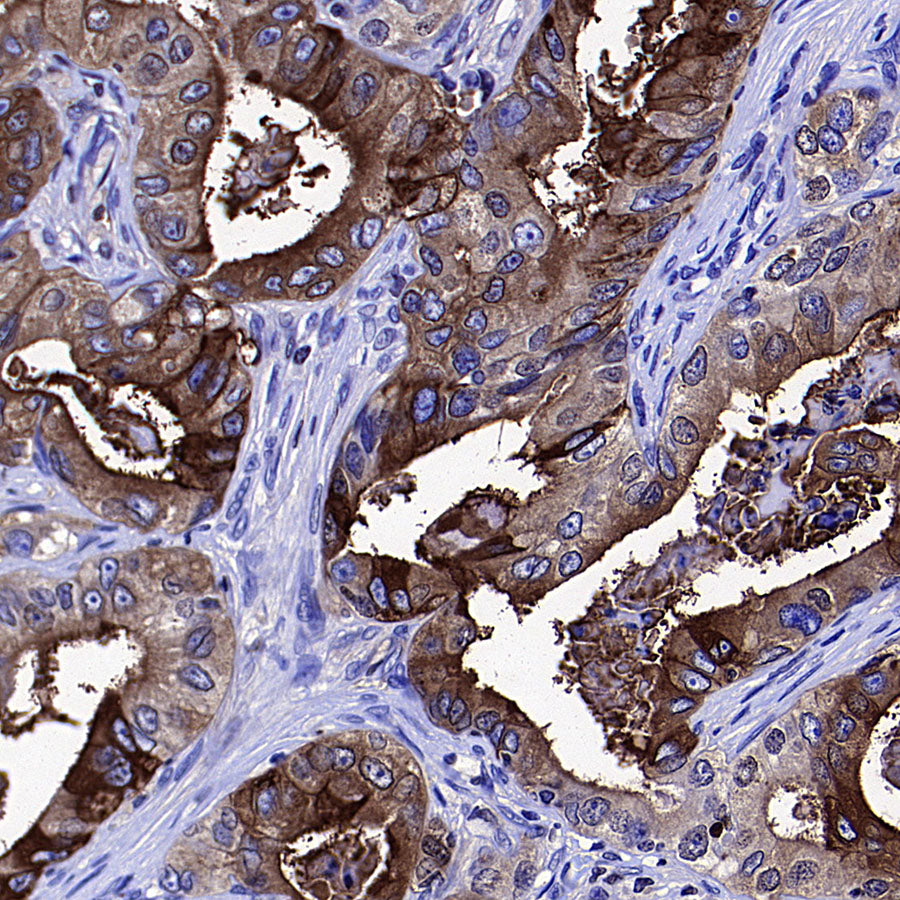 CEA Recombinant Rabbit mAb (SDT-098-41)