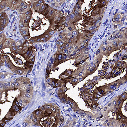 CEA Recombinant Rabbit mAb (SDT-098-41)