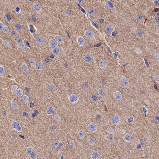 α-tubulin Rabbit Polyclonal Antibody